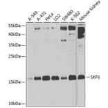 Western Blot - Anti-Skp1 Antibody (A14069) - Antibodies.com