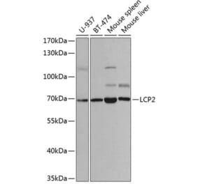 Western Blot - Anti-SLP76 Antibody (A14070) - Antibodies.com