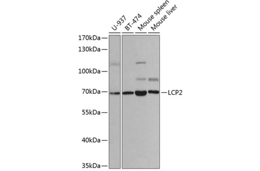 Western Blot - Anti-SLP76 Antibody (A14070) - Antibodies.com