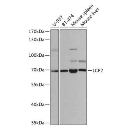 Western Blot - Anti-SLP76 Antibody (A14070) - Antibodies.com