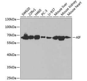 Western Blot - Anti-AIF Antibody (A14071) - Antibodies.com