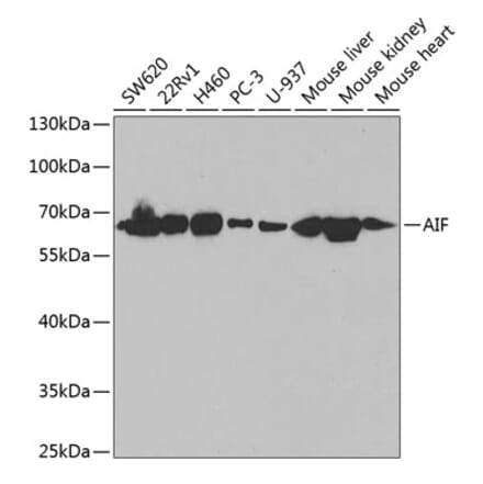 Western Blot - Anti-AIF Antibody (A14071) - Antibodies.com