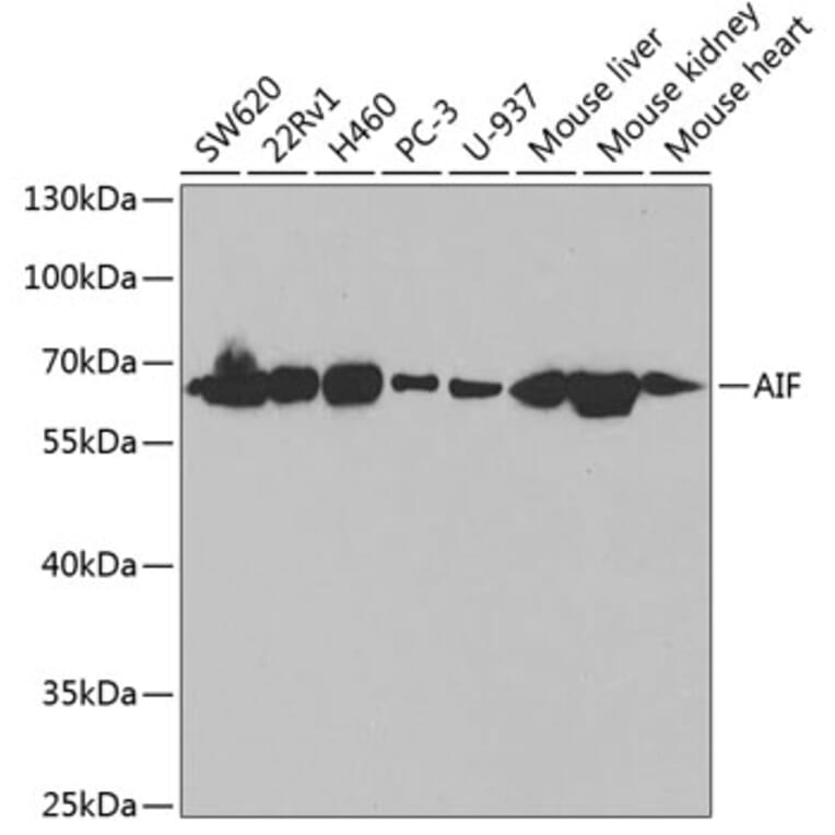 Western Blot - Anti-AIF Antibody (A14071) - Antibodies.com