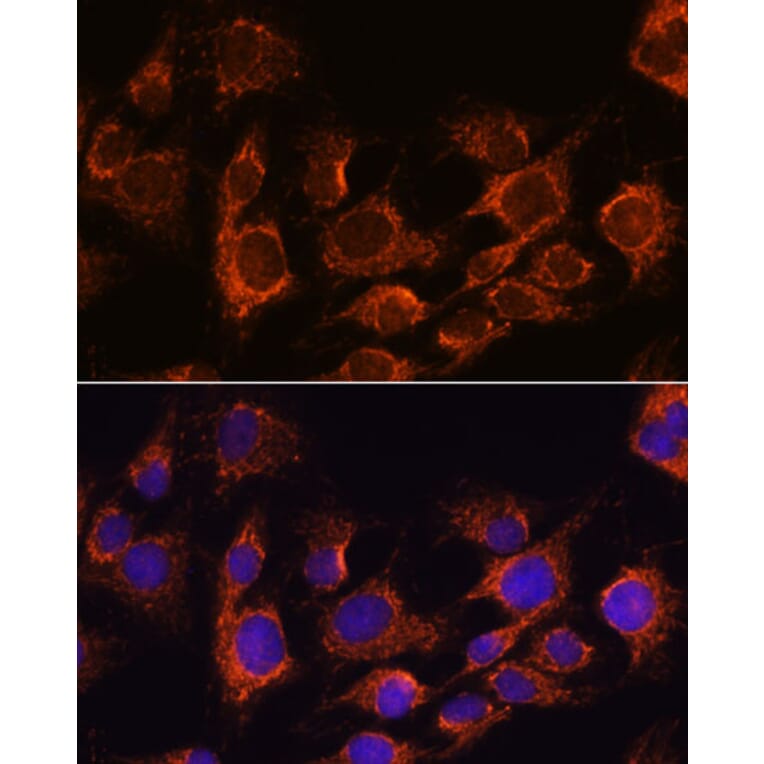 Immunofluorescence - Anti-AIF Antibody (A14071) - Antibodies.com