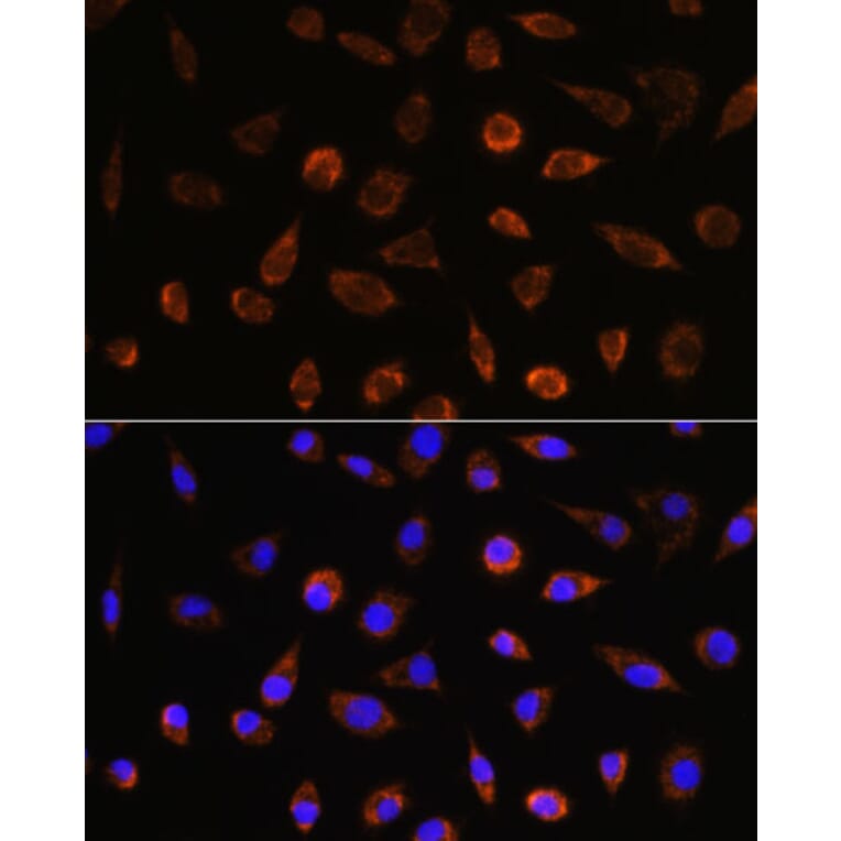 Immunofluorescence - Anti-AIF Antibody (A14071) - Antibodies.com