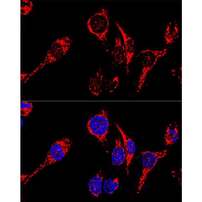 Immunofluorescence - Anti-AIF Antibody (A14071) - Antibodies.com