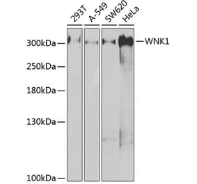 Western Blot - Anti-WNK1 Antibody (A14072) - Antibodies.com