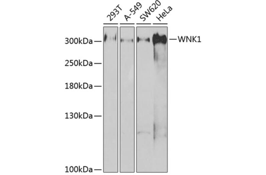 Western Blot - Anti-WNK1 Antibody (A14072) - Antibodies.com