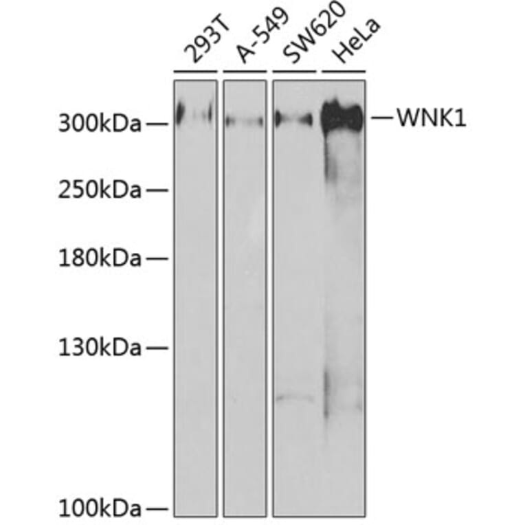 Western Blot - Anti-WNK1 Antibody (A14072) - Antibodies.com