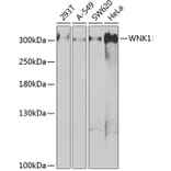 Western Blot - Anti-WNK1 Antibody (A14072) - Antibodies.com