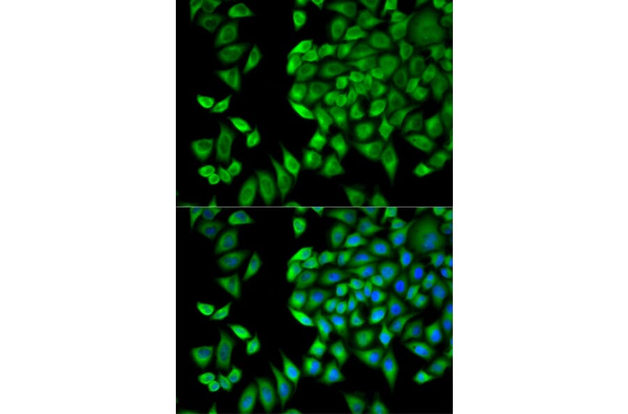 Immunofluorescence - Anti-WNK1 Antibody (A14072) - Antibodies.com