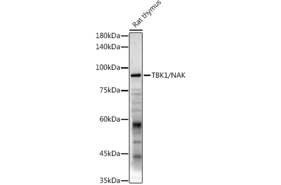 Western Blot - Anti-NAK/TBK1 Antibody (A14074) - Antibodies.com