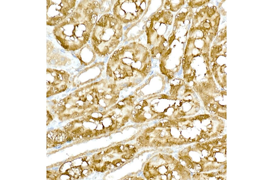 Immunohistochemistry - Anti-NAK/TBK1 Antibody (A14074) - Antibodies.com