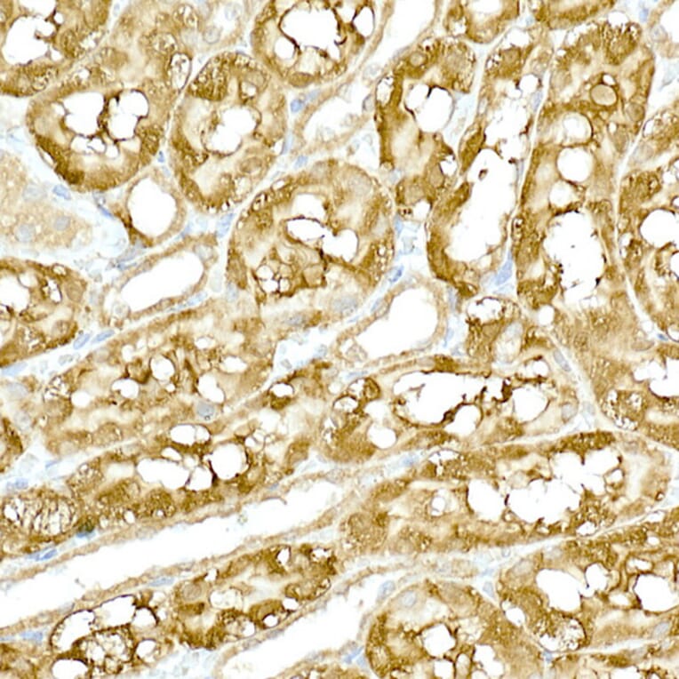 Immunohistochemistry - Anti-NAK/TBK1 Antibody (A14074) - Antibodies.com
