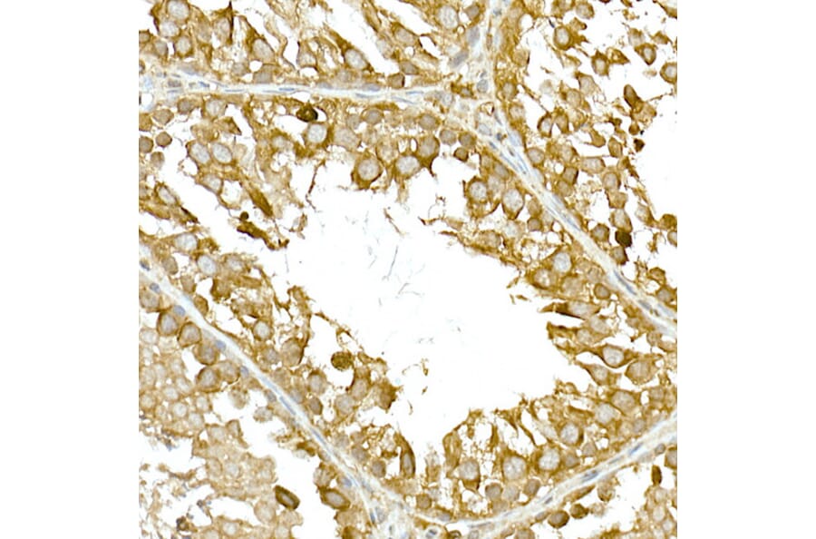Immunohistochemistry - Anti-NAK/TBK1 Antibody (A14074) - Antibodies.com