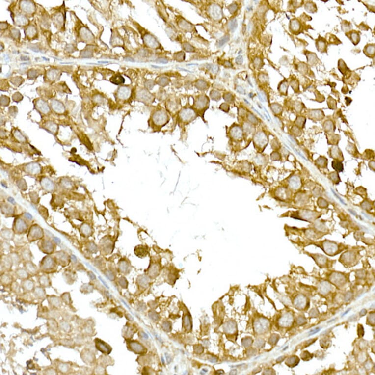 Immunohistochemistry - Anti-NAK/TBK1 Antibody (A14074) - Antibodies.com