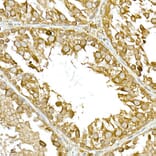 Immunohistochemistry - Anti-NAK/TBK1 Antibody (A14074) - Antibodies.com