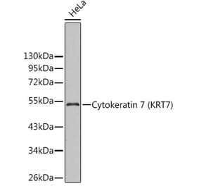 Western Blot - Anti-Cytokeratin 7 Antibody (A14075) - Antibodies.com