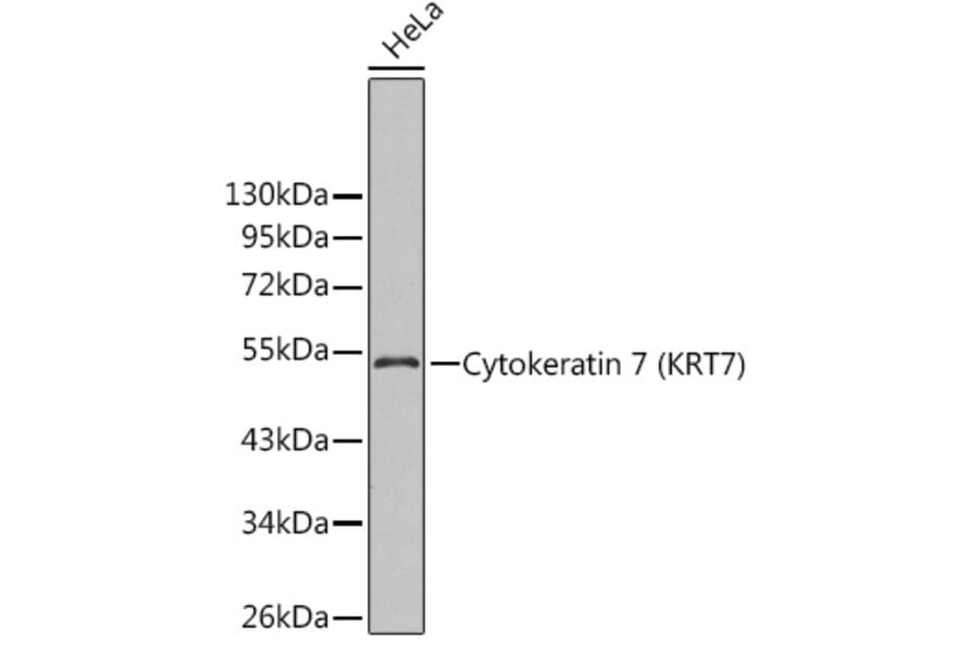 Western Blot - Anti-Cytokeratin 7 Antibody (A14075) - Antibodies.com