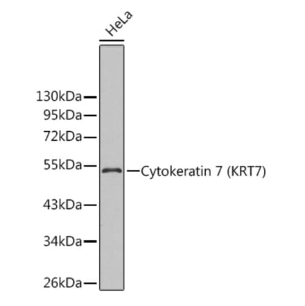 Western Blot - Anti-Cytokeratin 7 Antibody (A14075) - Antibodies.com
