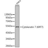 Western Blot - Anti-Cytokeratin 7 Antibody (A14075) - Antibodies.com