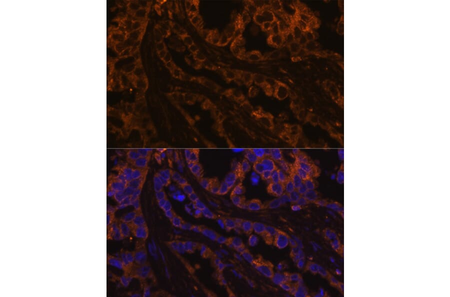 Immunofluorescence - Anti-Cytokeratin 7 Antibody (A14075) - Antibodies.com