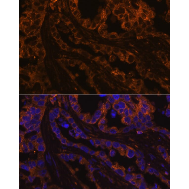 Immunofluorescence - Anti-Cytokeratin 7 Antibody (A14075) - Antibodies.com