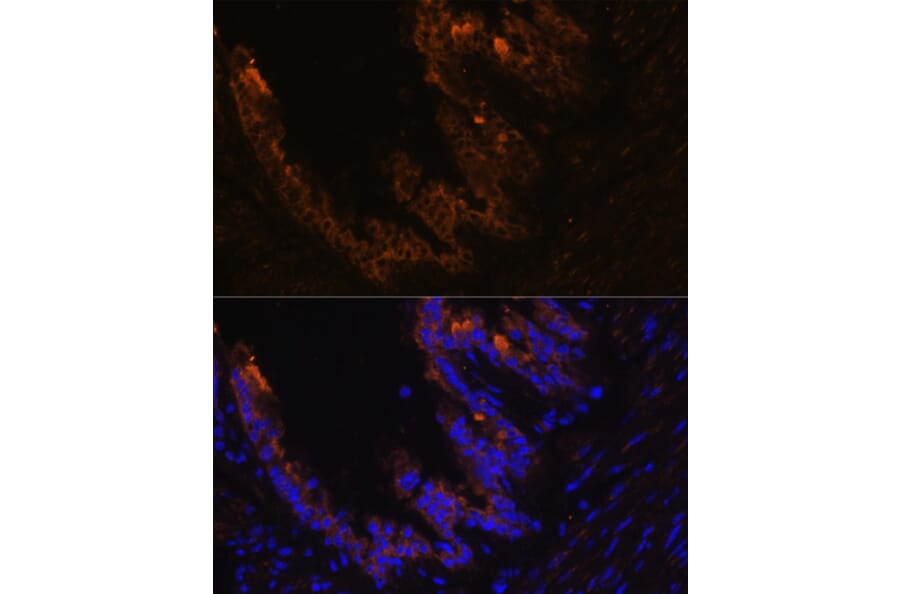 Immunofluorescence - Anti-Cytokeratin 7 Antibody (A14075) - Antibodies.com