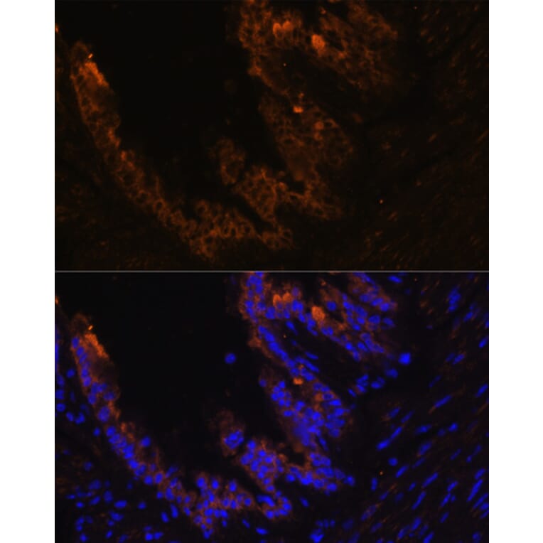 Immunofluorescence - Anti-Cytokeratin 7 Antibody (A14075) - Antibodies.com