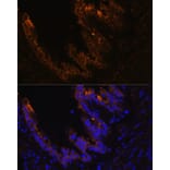 Immunofluorescence - Anti-Cytokeratin 7 Antibody (A14075) - Antibodies.com