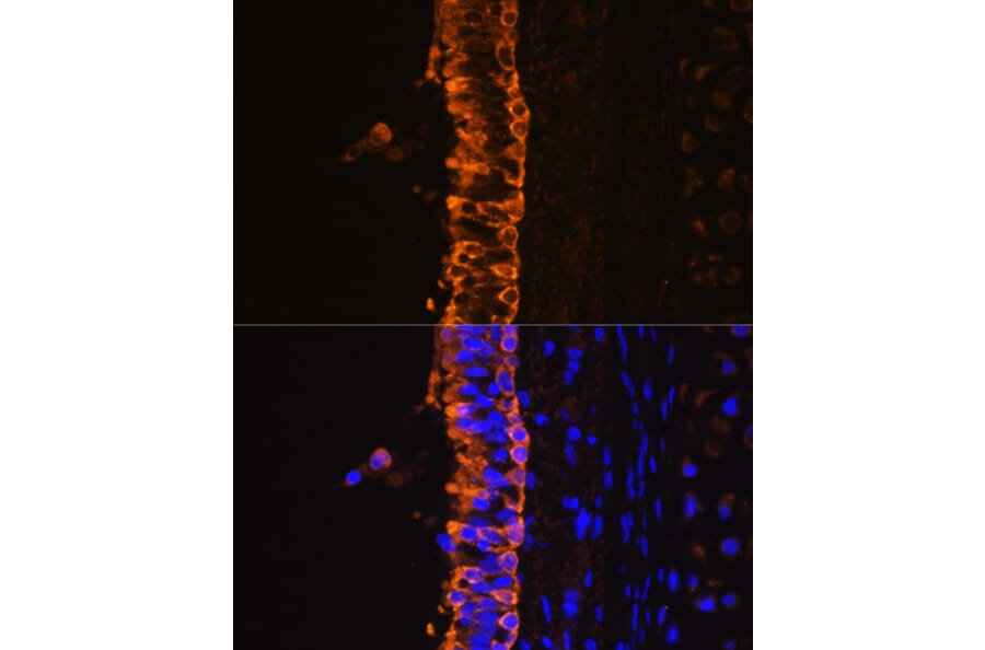 Immunofluorescence - Anti-Cytokeratin 7 Antibody (A14075) - Antibodies.com