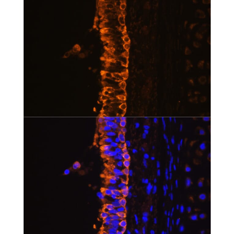 Immunofluorescence - Anti-Cytokeratin 7 Antibody (A14075) - Antibodies.com