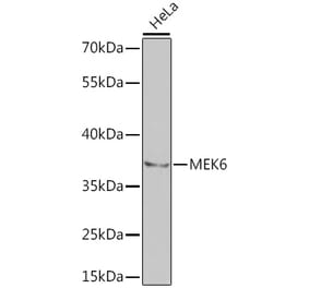 Western Blot - Anti-MKK6 Antibody (A14076) - Antibodies.com