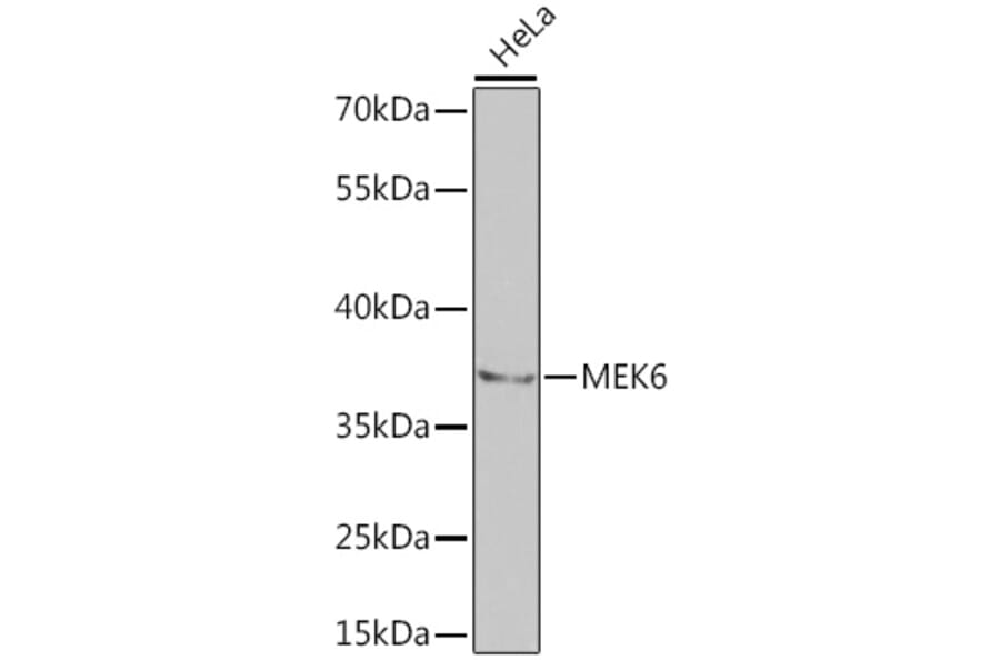 Western Blot - Anti-MKK6 Antibody (A14076) - Antibodies.com