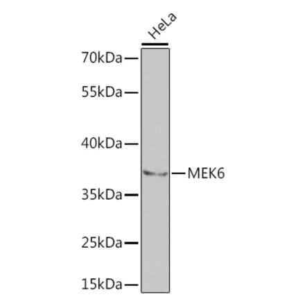 Western Blot - Anti-MKK6 Antibody (A14076) - Antibodies.com