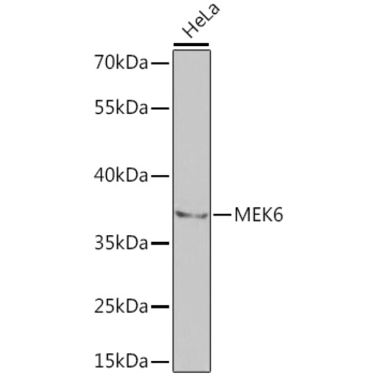 Western Blot - Anti-MKK6 Antibody (A14076) - Antibodies.com