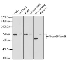 Western Blot - Anti-N WASP Antibody (A14077) - Antibodies.com