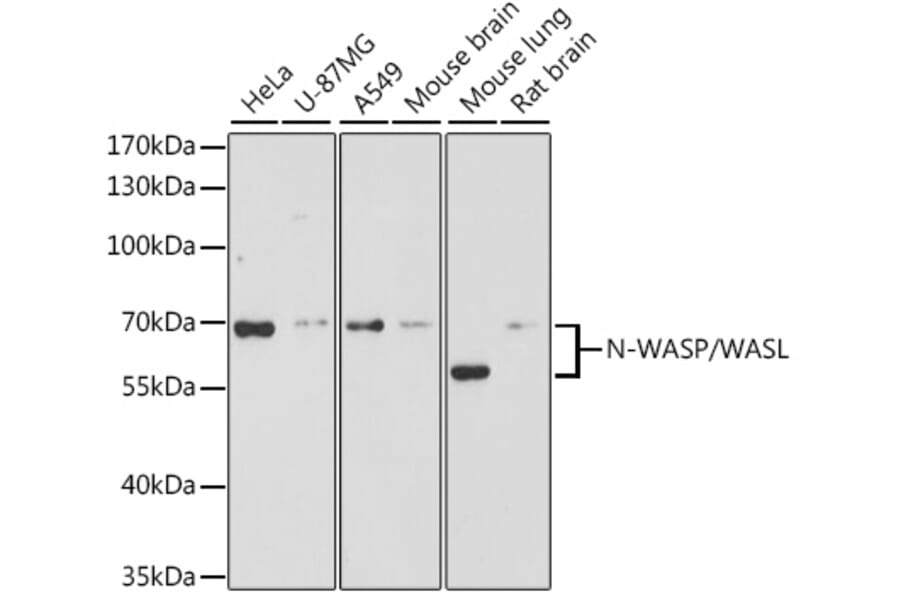 Western Blot - Anti-N WASP Antibody (A14077) - Antibodies.com