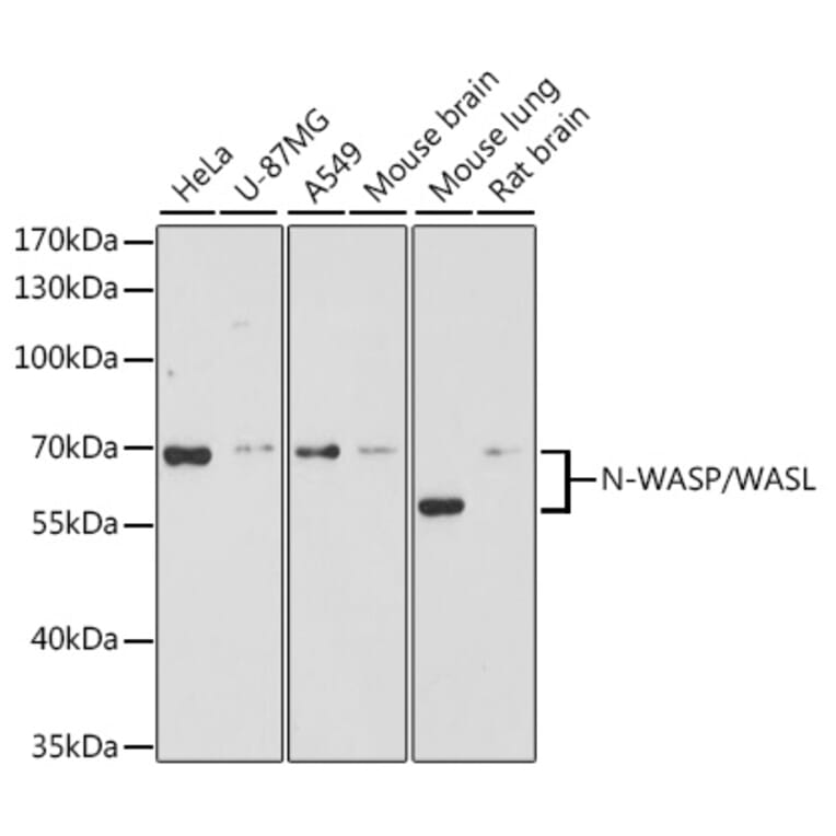 Western Blot - Anti-N WASP Antibody (A14077) - Antibodies.com