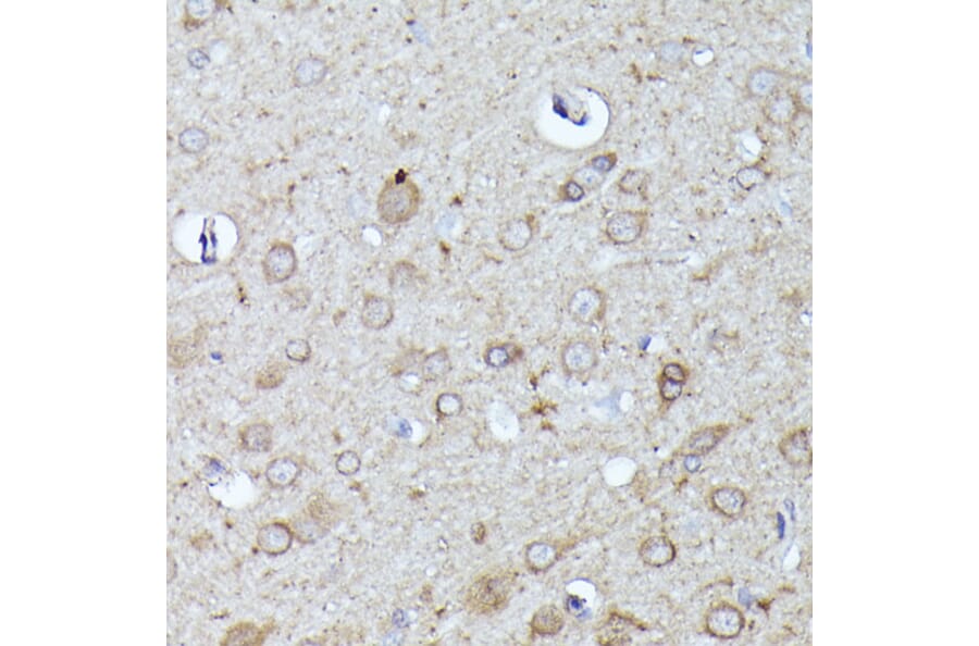 Immunohistochemistry - Anti-N WASP Antibody (A14077) - Antibodies.com