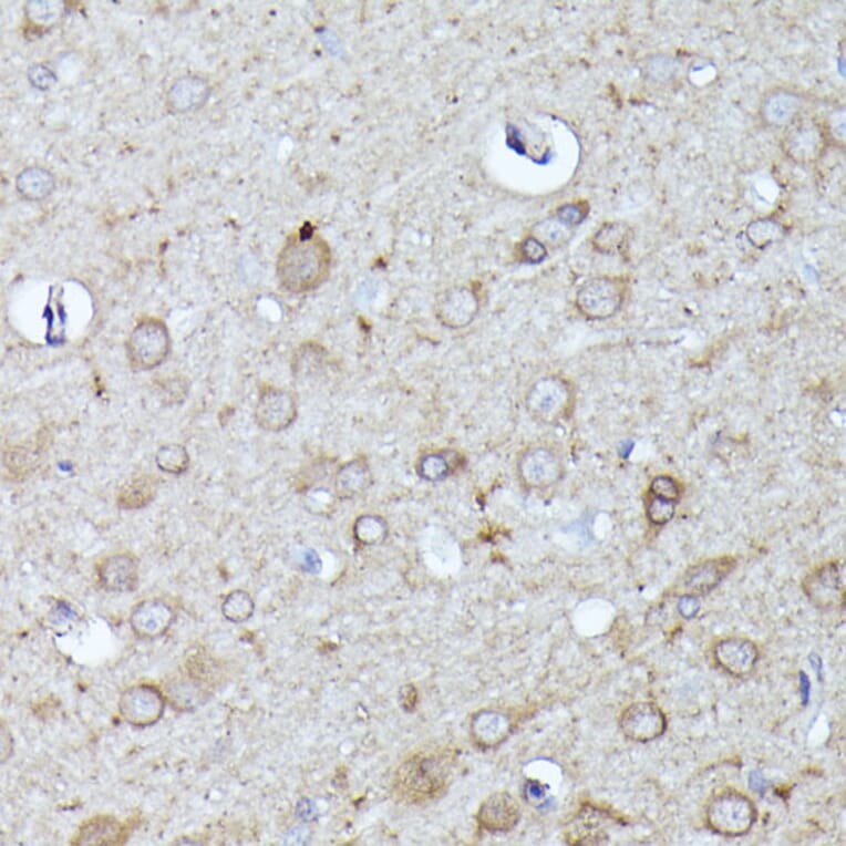 Immunohistochemistry - Anti-N WASP Antibody (A14077) - Antibodies.com