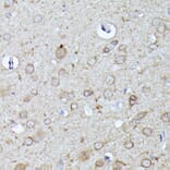 Immunohistochemistry - Anti-N WASP Antibody (A14077) - Antibodies.com