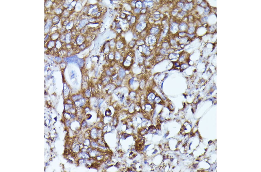 Immunohistochemistry - Anti-N WASP Antibody (A14077) - Antibodies.com