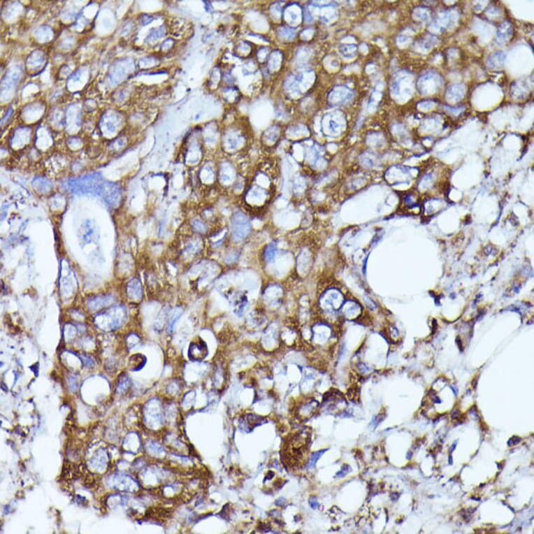 Immunohistochemistry - Anti-N WASP Antibody (A14077) - Antibodies.com