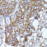Immunohistochemistry - Anti-N WASP Antibody (A14077) - Antibodies.com
