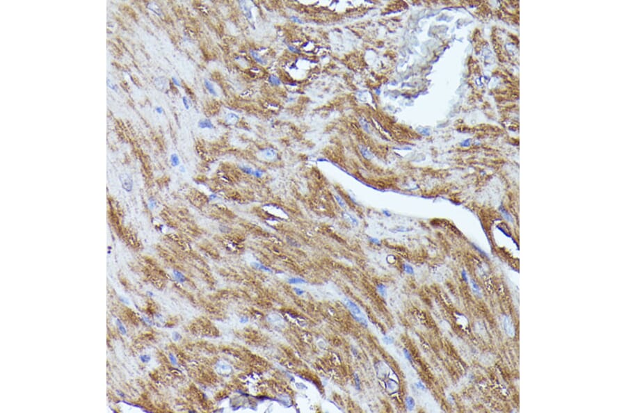 Immunohistochemistry - Anti-N WASP Antibody (A14077) - Antibodies.com