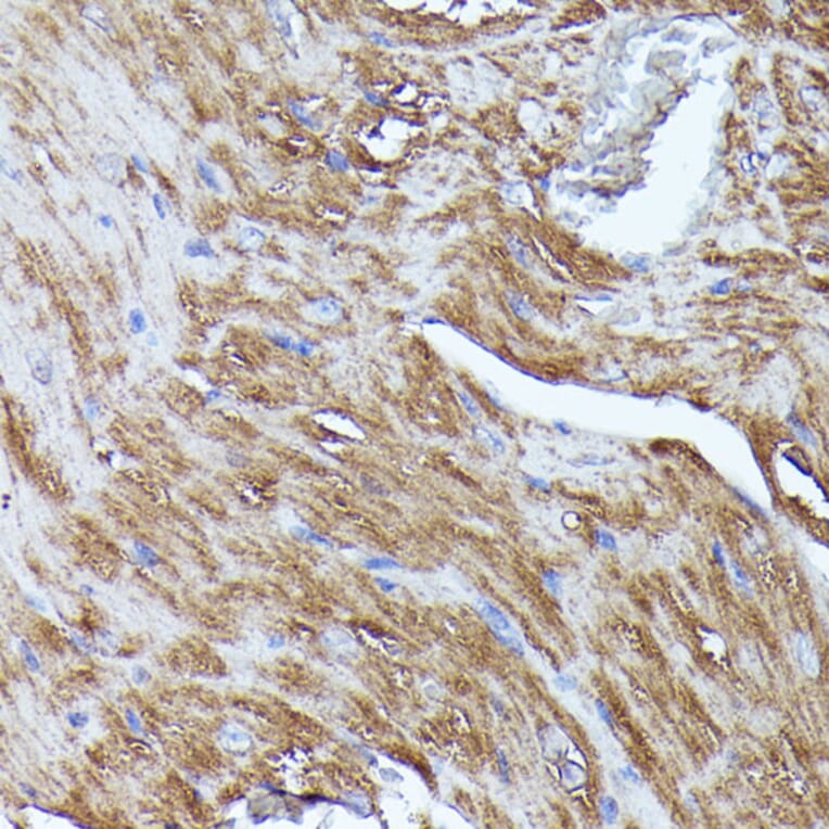 Immunohistochemistry - Anti-N WASP Antibody (A14077) - Antibodies.com