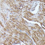 Immunohistochemistry - Anti-N WASP Antibody (A14077) - Antibodies.com