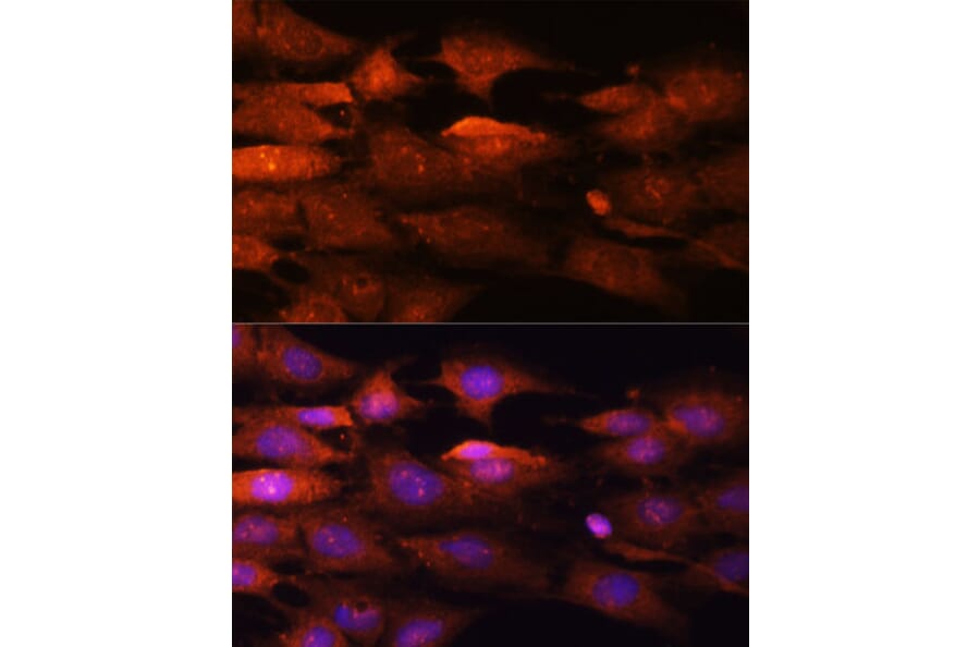 Immunofluorescence - Anti-N WASP Antibody (A14077) - Antibodies.com