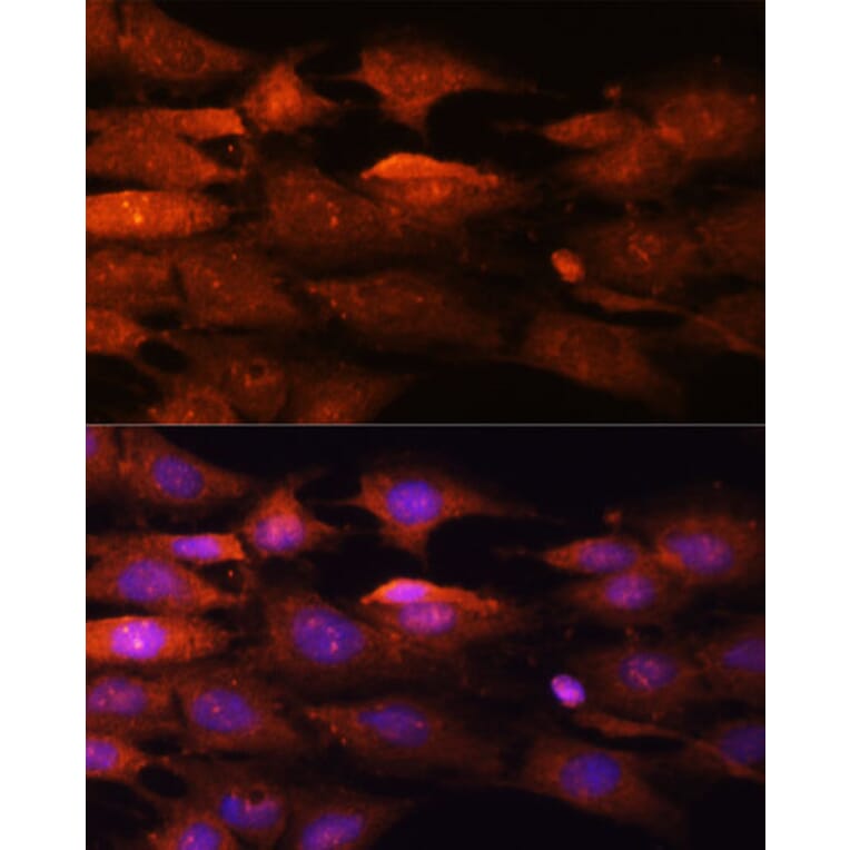 Immunofluorescence - Anti-N WASP Antibody (A14077) - Antibodies.com